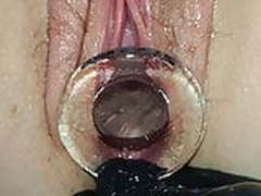 Glass gape Free XXX | xvideosearch.com