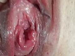 Urethra close up Full Video | xvideosearch.com