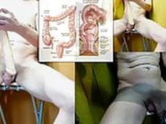 double dong anal ass insertion Full Video | xvideosearch.com