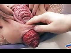 Worlds most RUINED cunt Full Video | xvideosearch.com